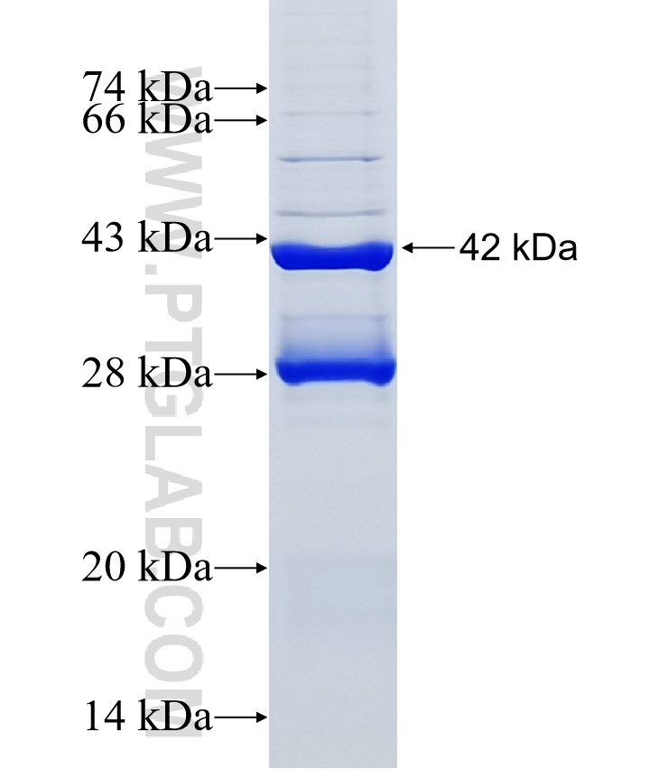 SLC5A12 fusion protein Ag5880 SDS-PAGE