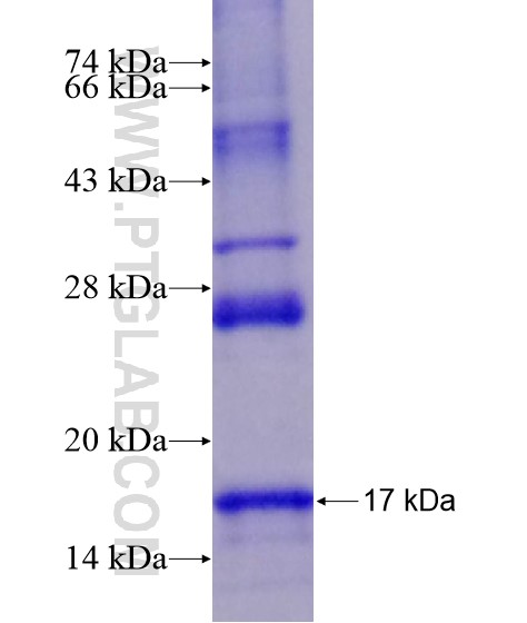 SLC5A2 fusion protein Ag19047 SDS-PAGE SLC5A2 fusion protein Ag19047 SDS-PAGE