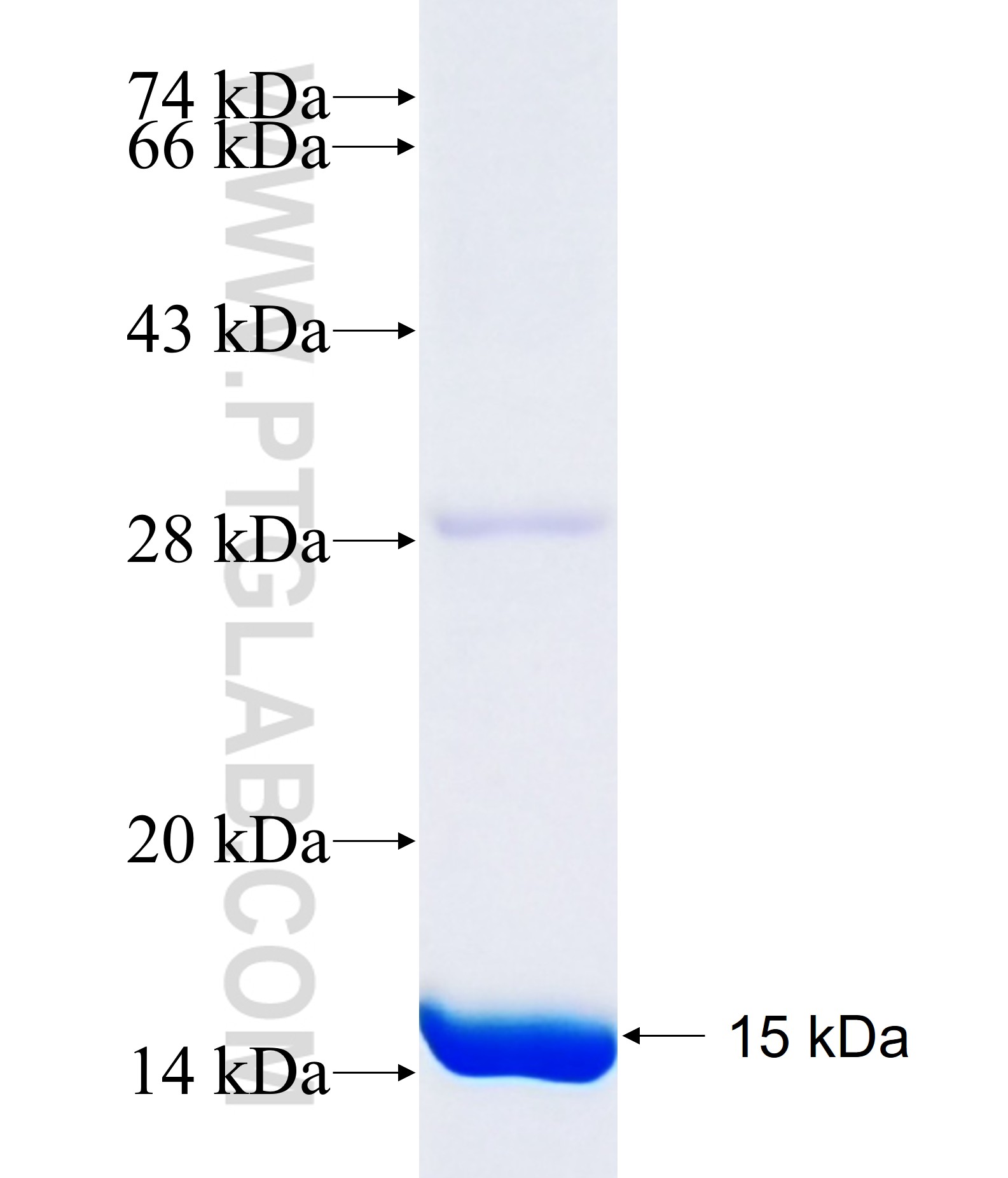 SLC5A3 fusion protein Ag32191 SDS-PAGE SLC5A3 fusion protein Ag32191 SDS-PAGE