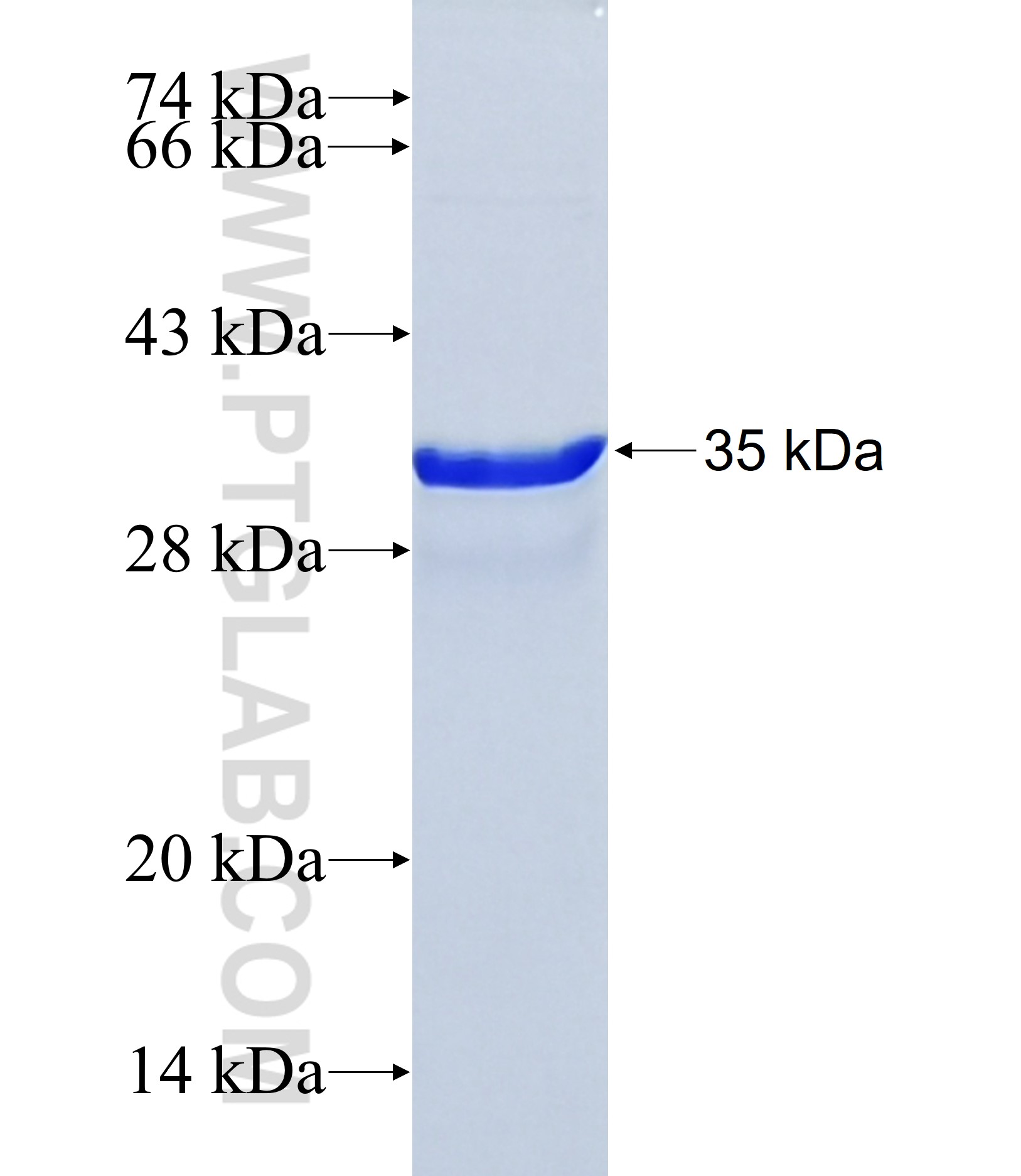 SLC5A3 fusion protein Ag32195 SDS-PAGE
