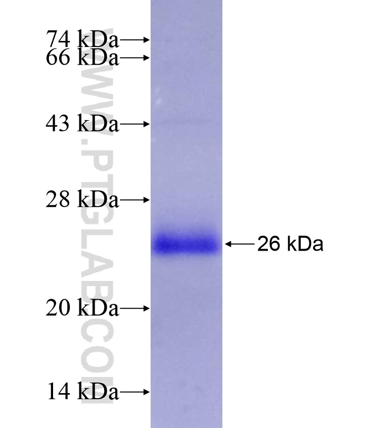 SLC5A3 fusion protein Ag17111 SDS-PAGE SLC5A3 fusion protein Ag17111 SDS-PAGE