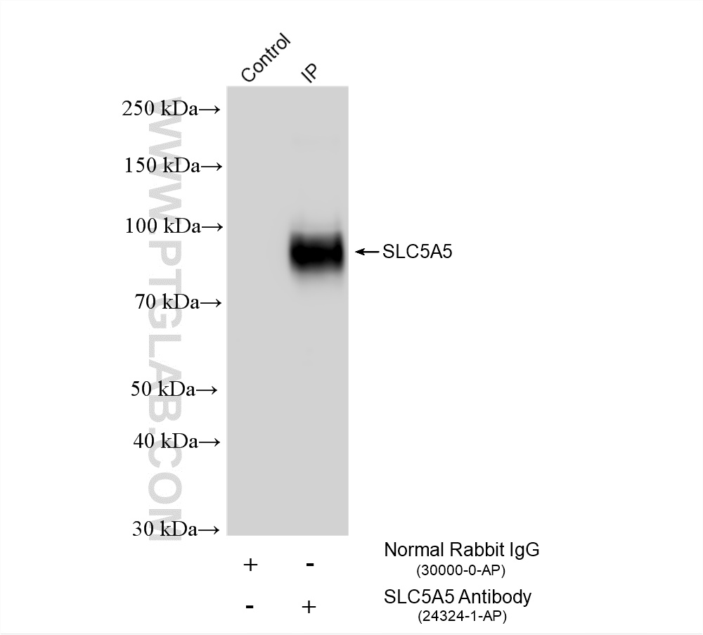 IP experiment of MCF-7 using 24324-1-AP