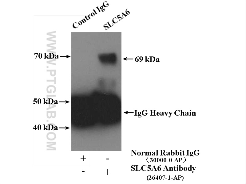 IP experiment of mouse brain using 26407-1-AP