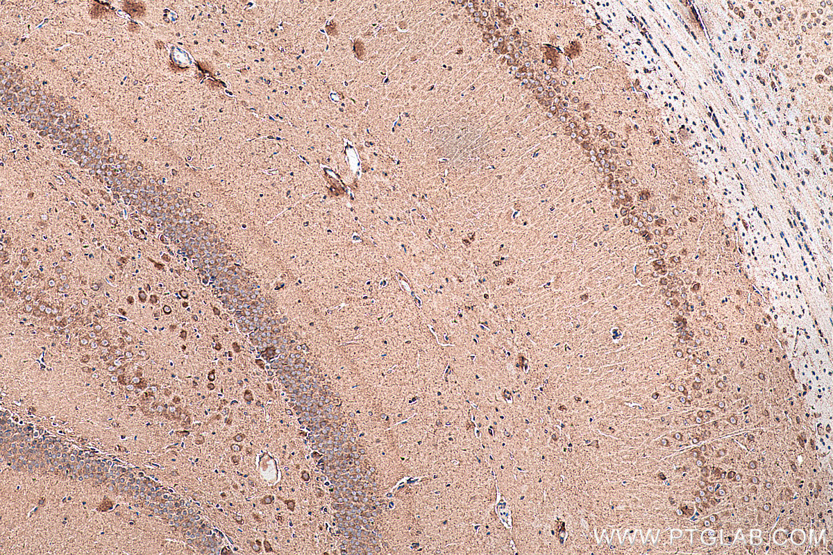 IHC staining of rat brain using 21848-1-AP