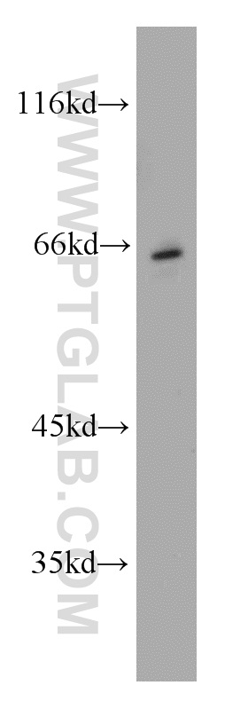 WB analysis of mouse brain using 21848-1-AP