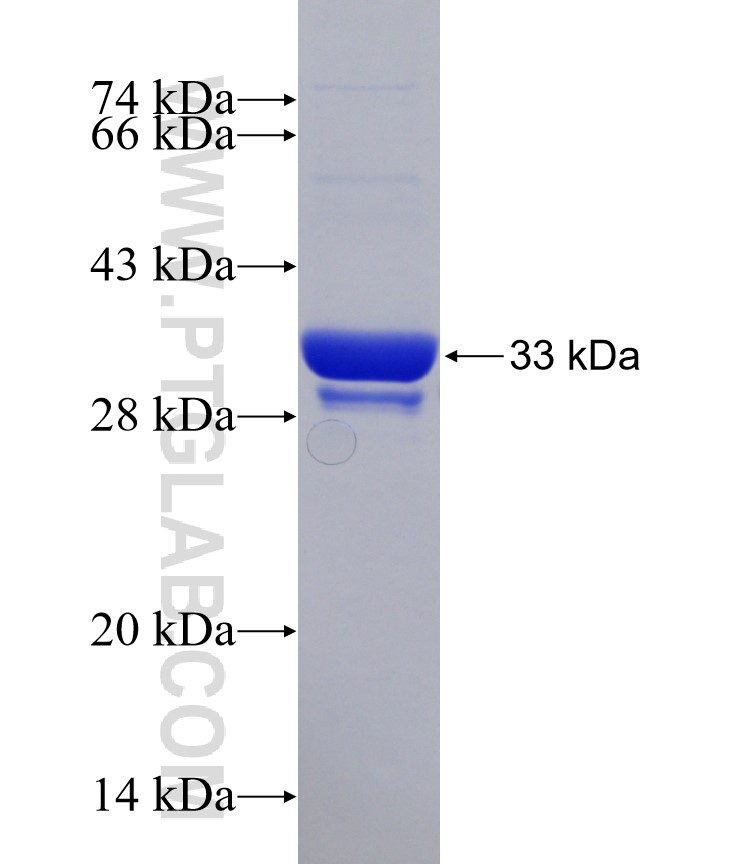 SLC5A7 fusion protein Ag30983 SDS-PAGE