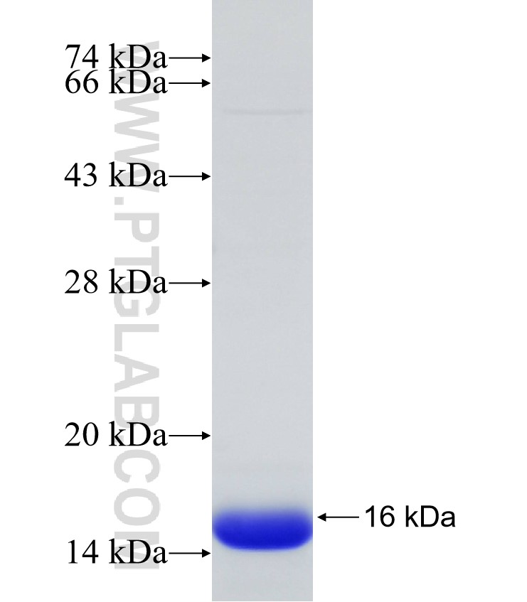 SLC5A7 fusion protein Ag31031 SDS-PAGE