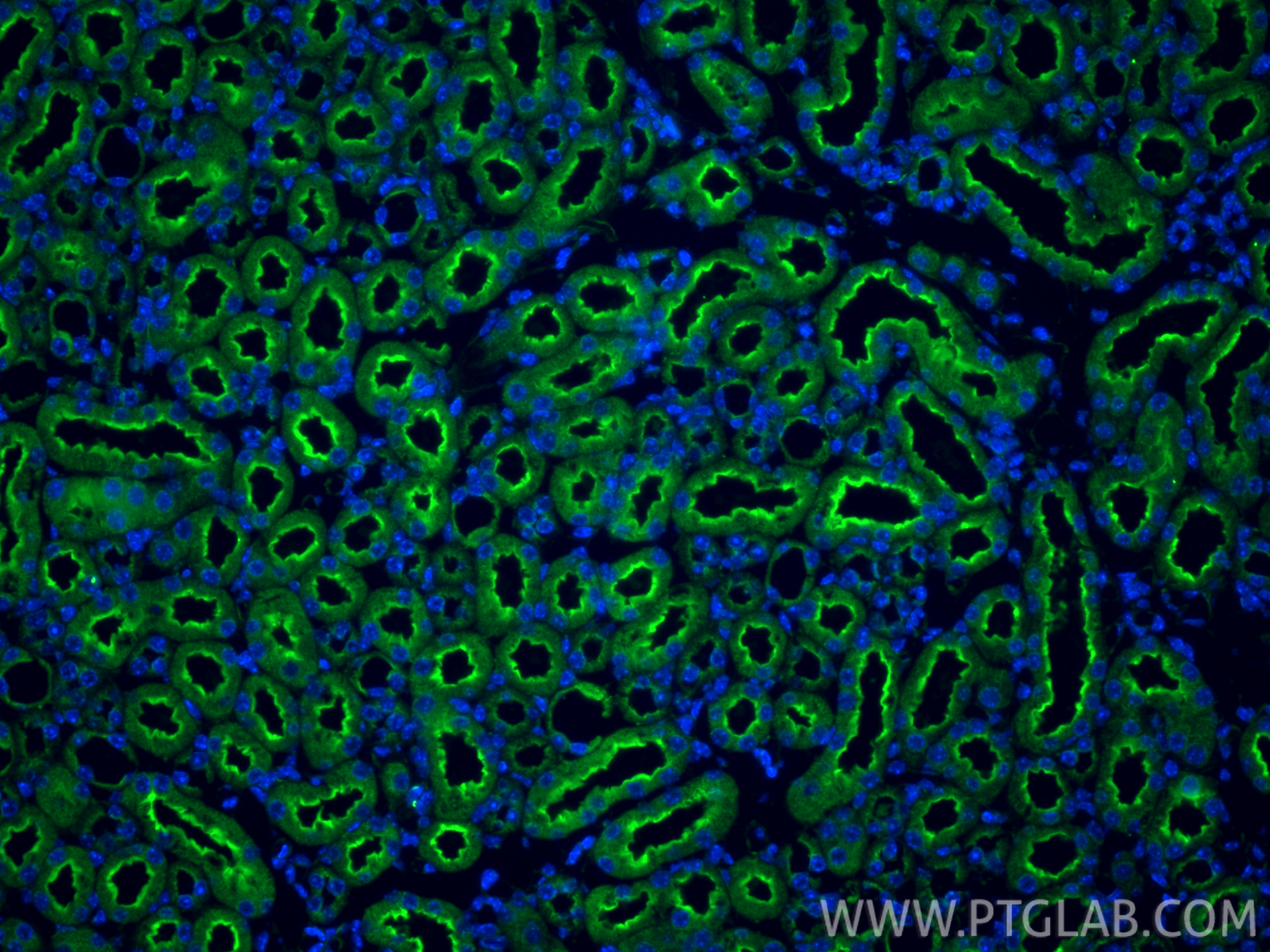 Immunofluorescent analysis of (4% PFA) fixed paraffin-embedded mouse kidney tissue using SLC5A8 antibody (21433-1-AP) at dilution of 1:400 and CoraLite®488-Conjugated Goat Anti-Rabbit IgG(H+L) (<a class='green' href='/productredirect?CatalogNo=SA00013-2' target='_blank'>SA00013-2</a>). Heat mediated antigen retrieval with Tris-EDTA buffer (pH 9.0). IF Staining of mouse kidney using 21433-1-AP