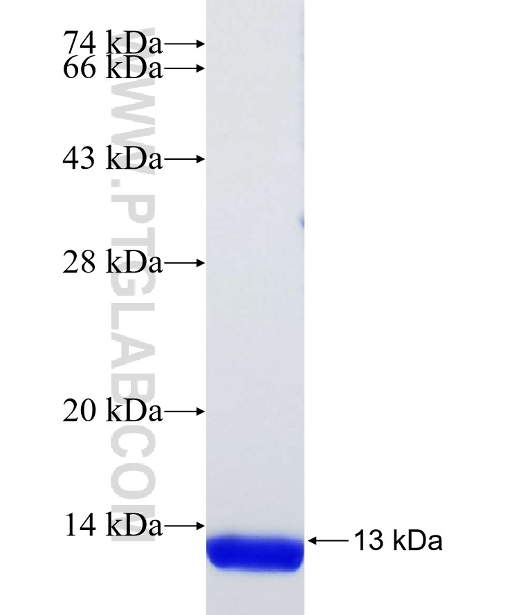 SLC5A8 fusion protein Ag30195 SDS-PAGE SLC5A8 fusion protein Ag30195 SDS-PAGE