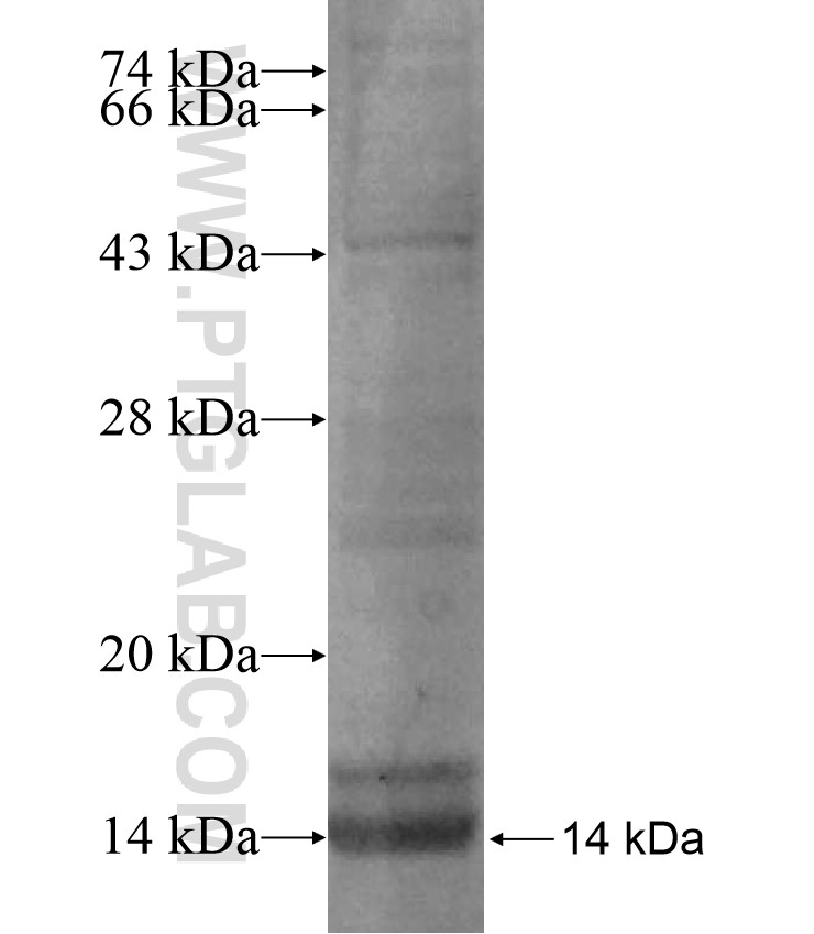 SLC5A8 fusion protein Ag17276 SDS-PAGE SLC5A8 fusion protein Ag17276 SDS-PAGE