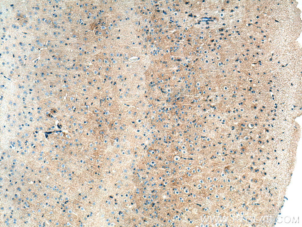 IHC staining of mouse brain using 13920-1-AP