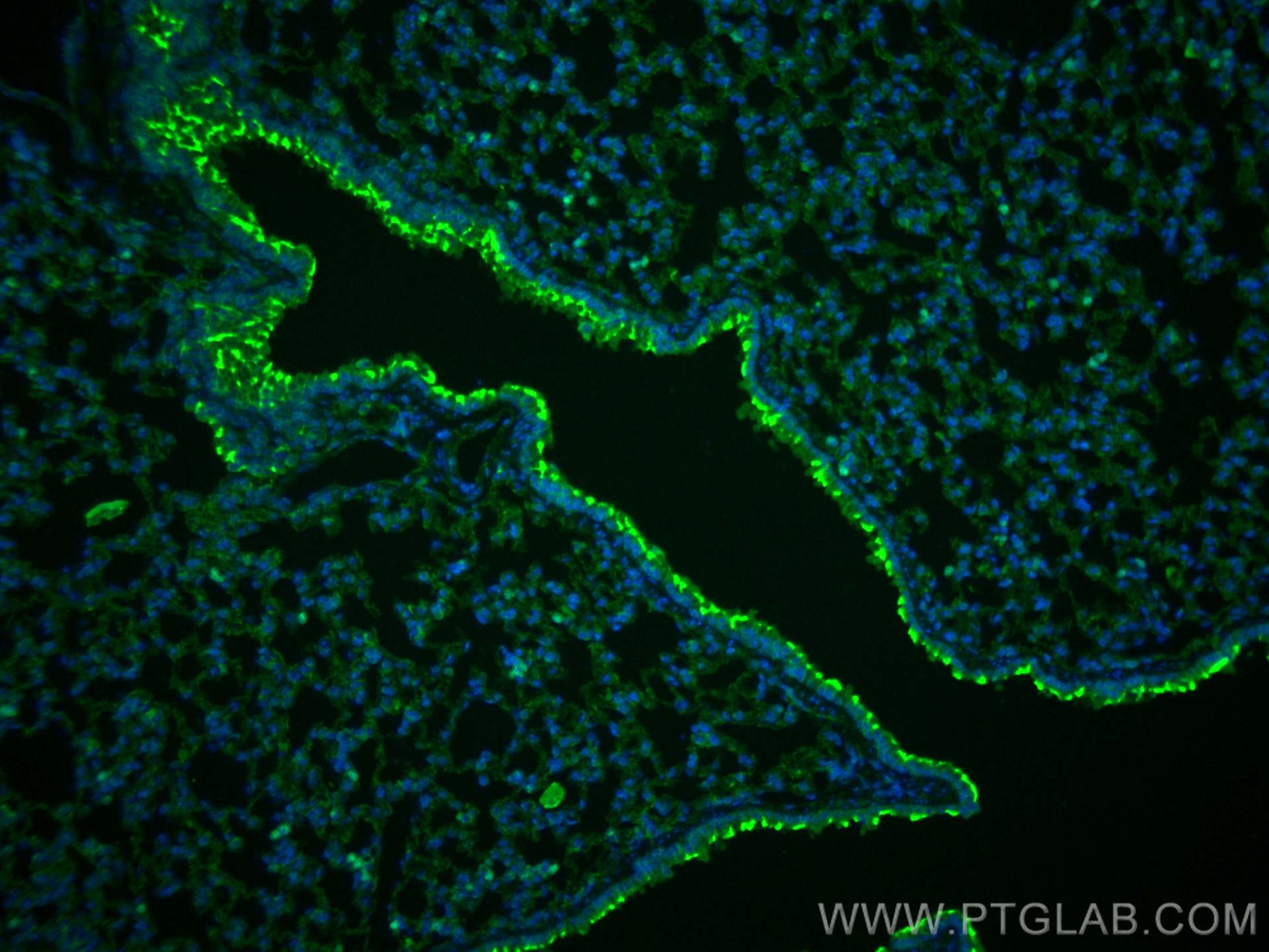 IF Staining of mouse lung using 18388-1-AP
