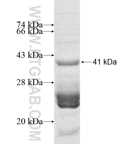 SLC6A16 fusion protein Ag10574 SDS-PAGE SLC6A16 fusion protein Ag10574 SDS-PAGE