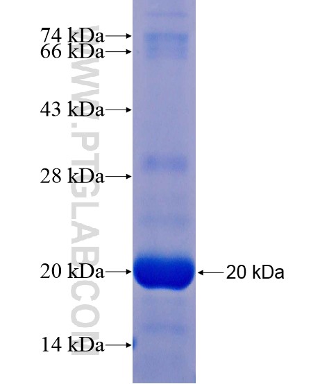 SLC6A16 fusion protein Ag21126 SDS-PAGE