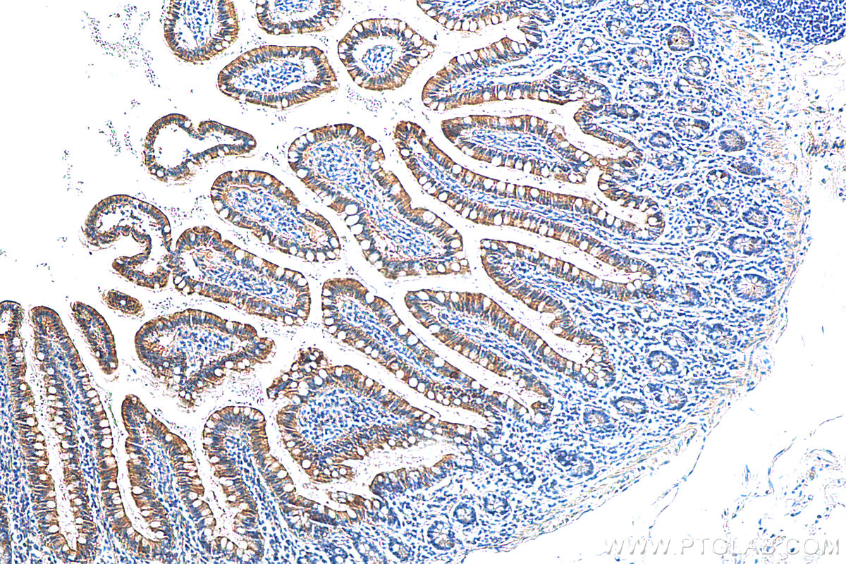 IHC staining of human small intestine using 27575-1-AP