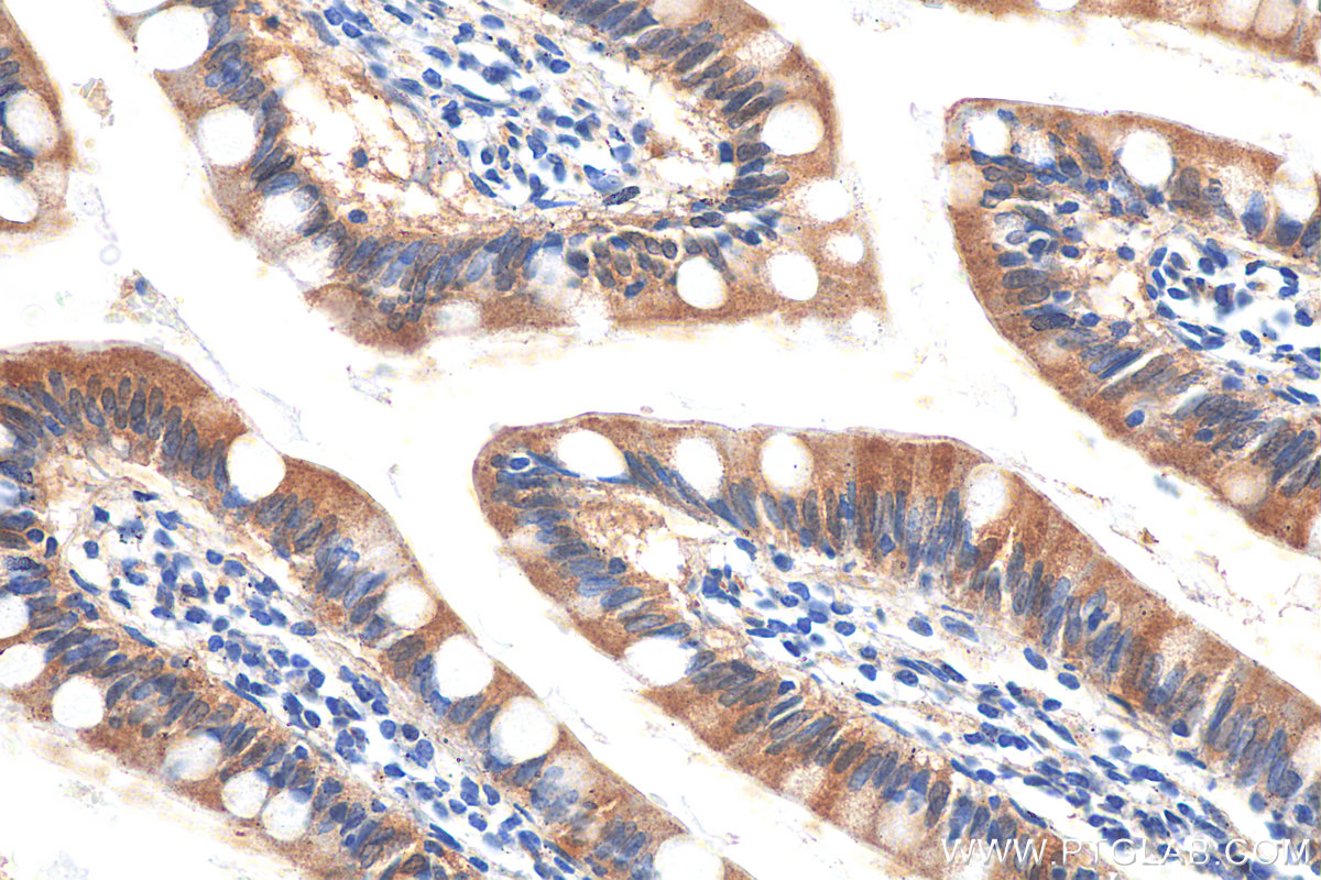 IHC staining of human small intestine using 27575-1-AP