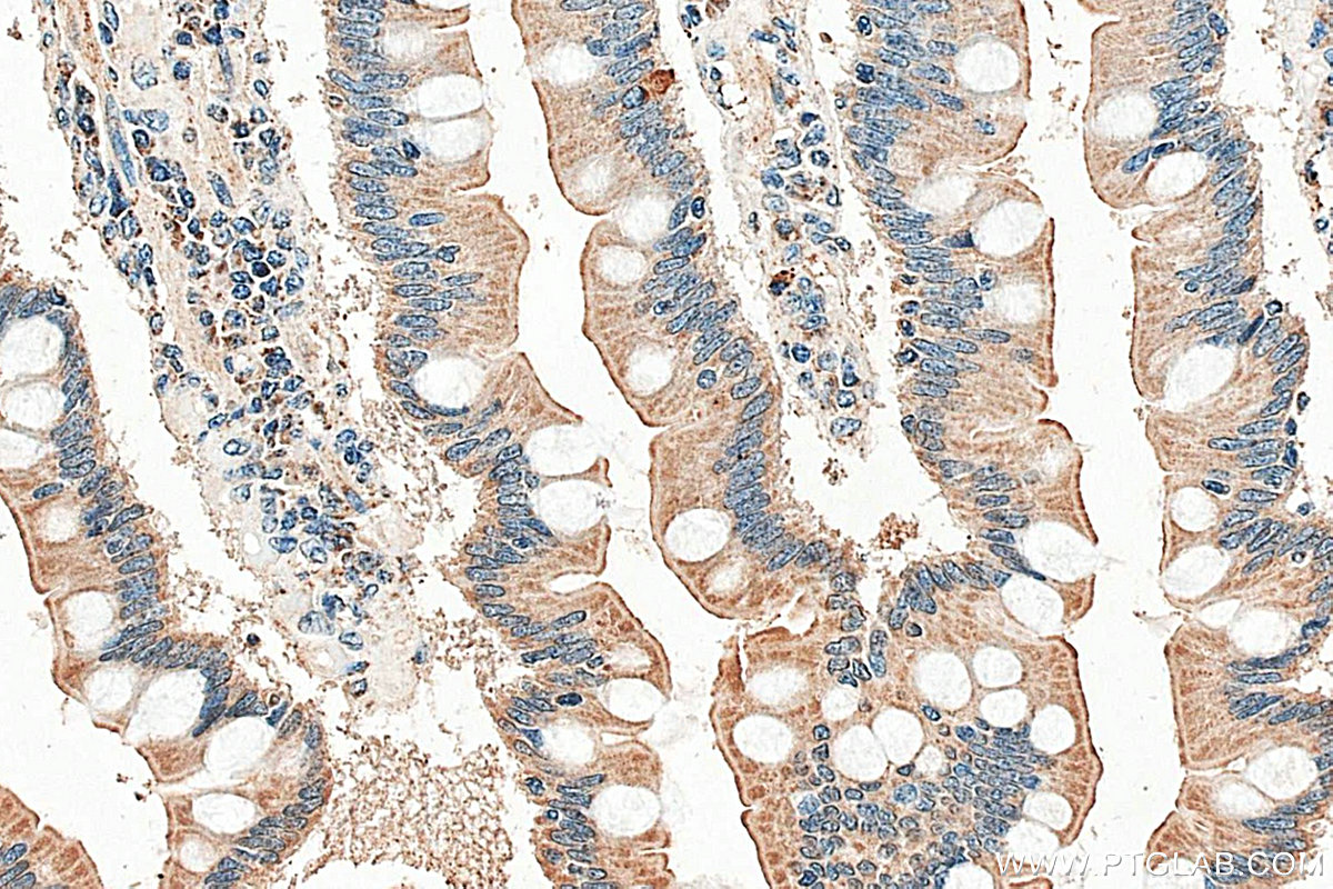 IHC staining of human small intestine using 29372-1-AP IHC staining of human small intestine using 29372-1-AP