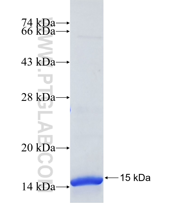 SLC6A2 fusion protein Ag40050 SDS-PAGE SLC6A2 fusion protein Ag40050 SDS-PAGE