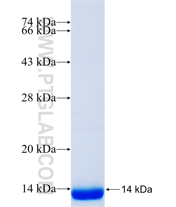 SLC6A2 fusion protein Ag40431 SDS-PAGE