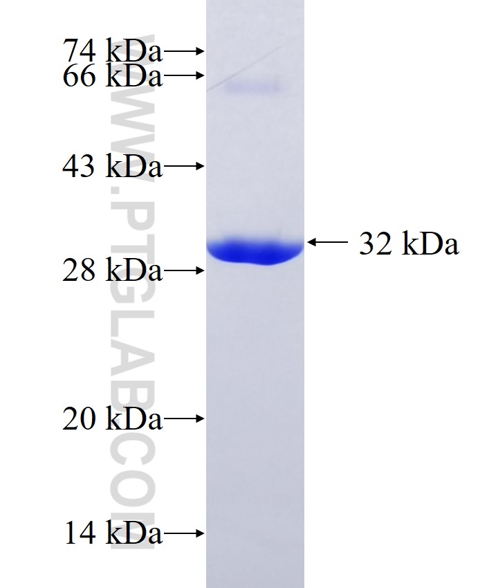 SLC6A2 fusion protein Ag13289 SDS-PAGE