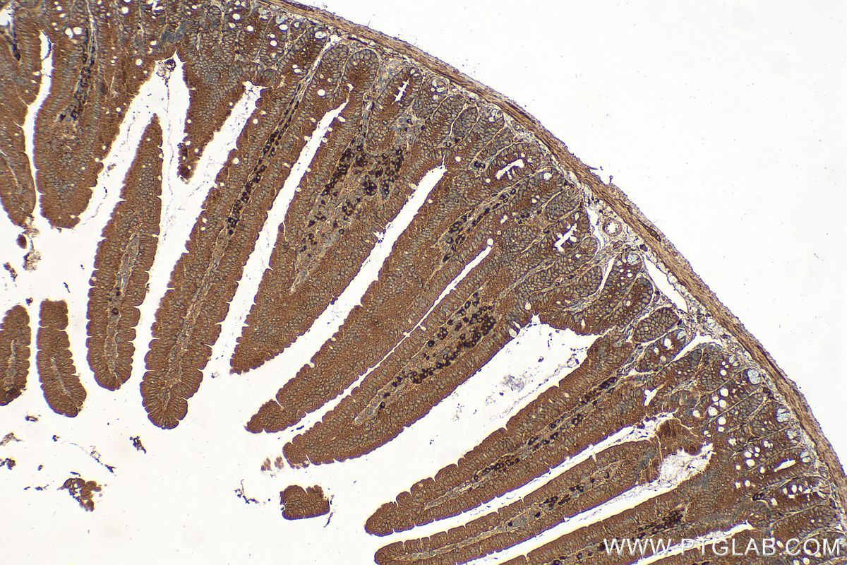 IHC staining of mouse small intestine using 30843-1-AP
