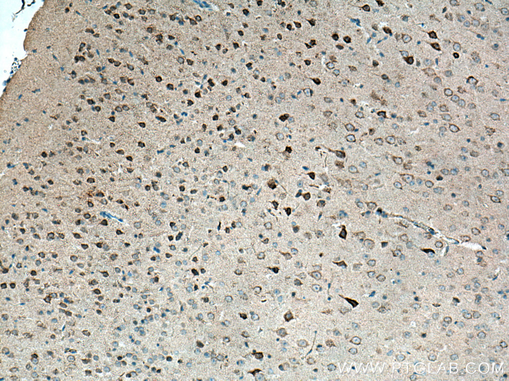 IHC staining of mouse brain using 22524-1-AP