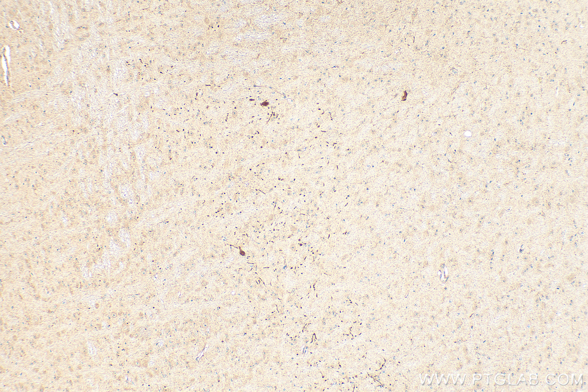 IHC staining of mouse brain using 22524-1-AP