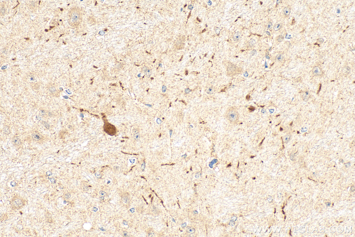 IHC staining of mouse brain using 22524-1-AP