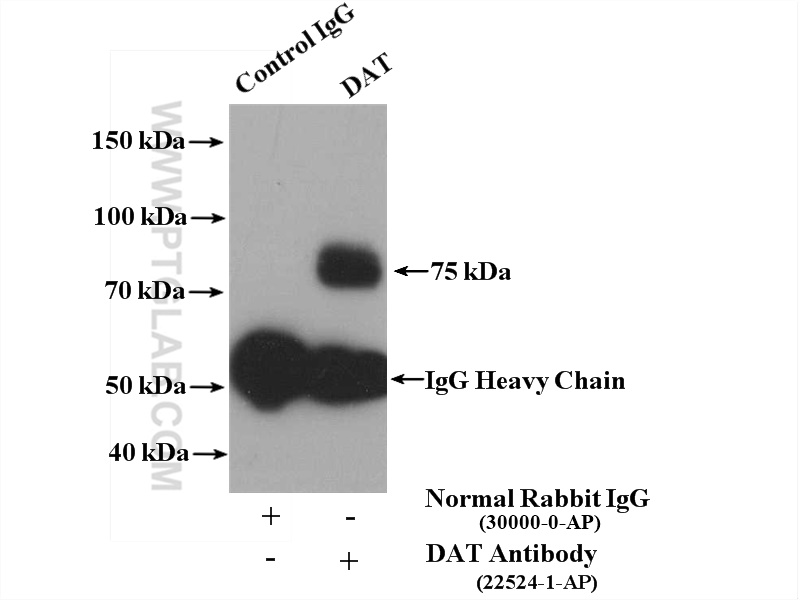 IP experiment of mouse brain using 22524-1-AP