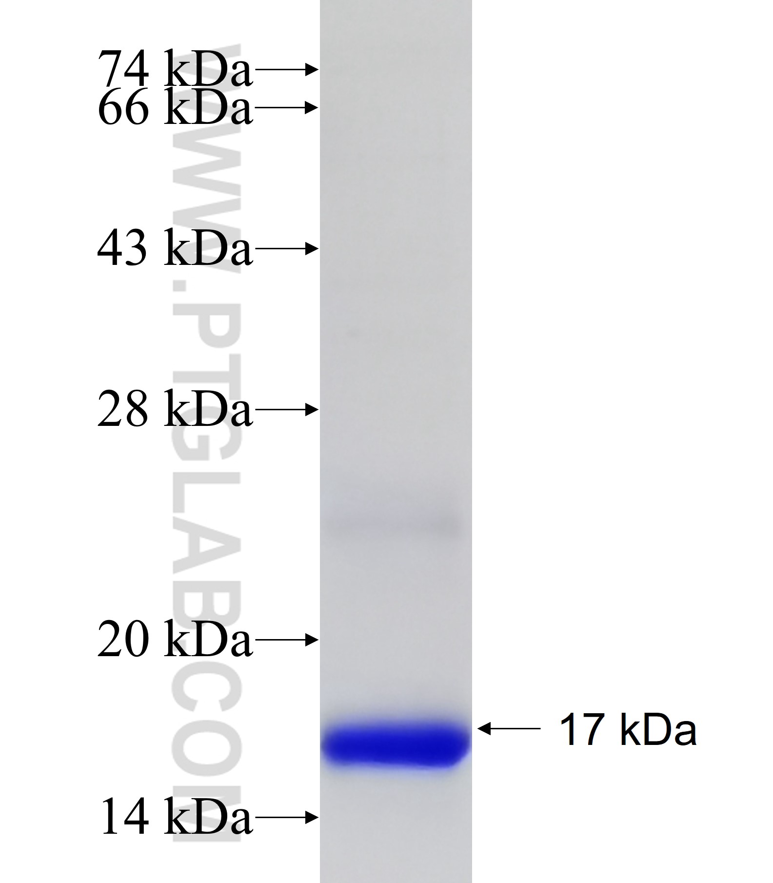 SLC6A3 fusion protein Ag19814 SDS-PAGE SLC6A3 fusion protein Ag19814 SDS-PAGE