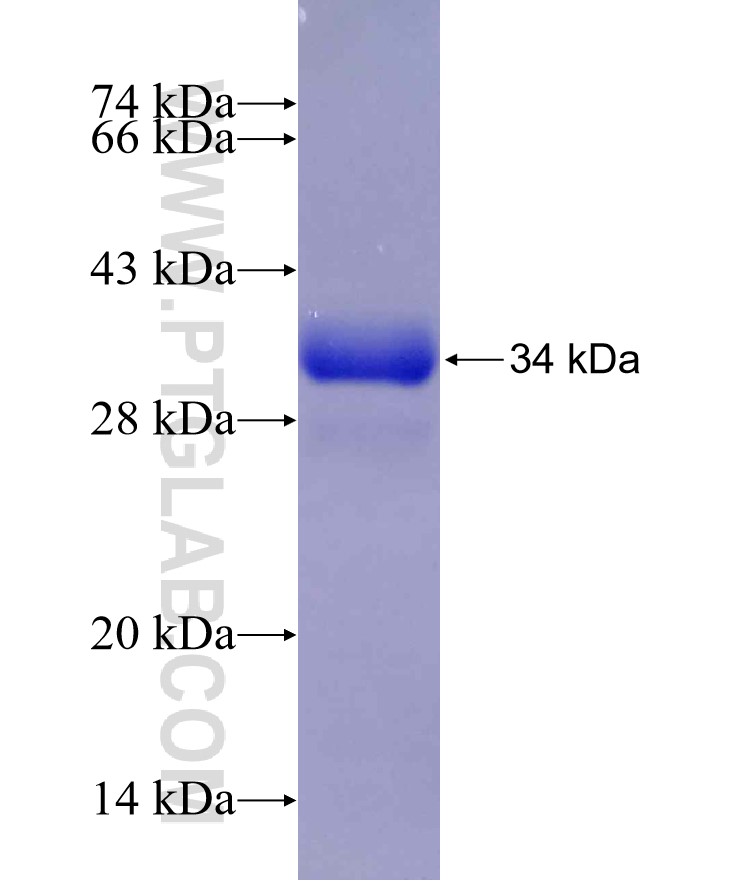 SLC6A3 fusion protein Ag30045 SDS-PAGE SLC6A3 fusion protein Ag30045 SDS-PAGE