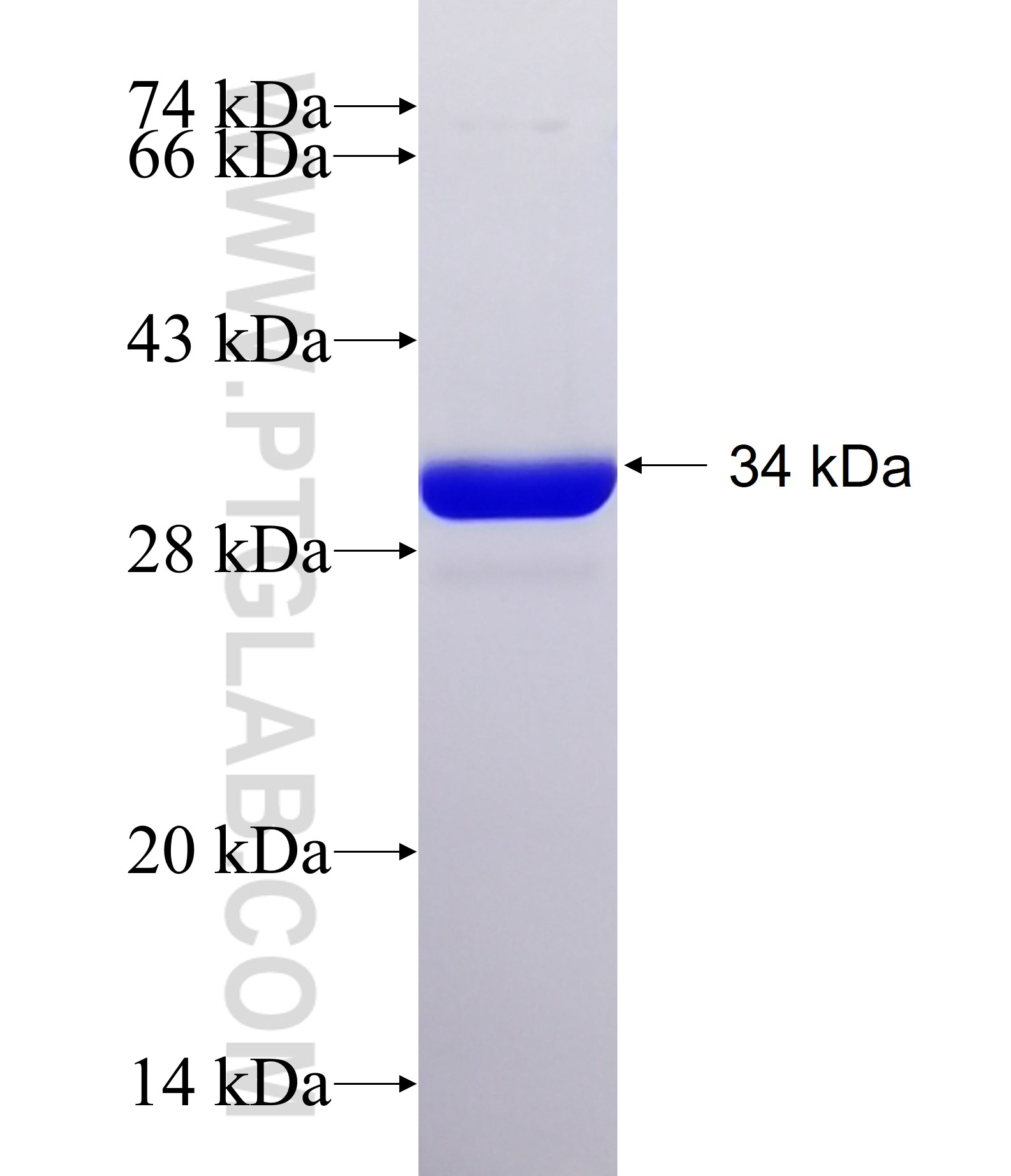 SLC6A3 fusion protein Ag18297 SDS-PAGE