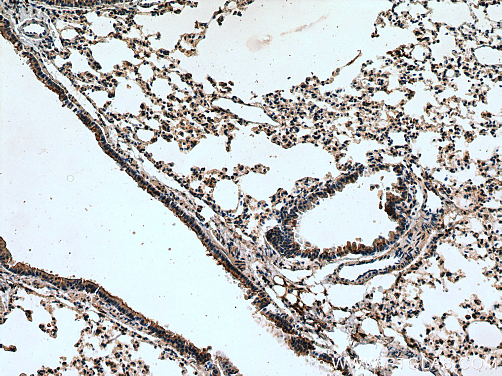 Serotonin transporter