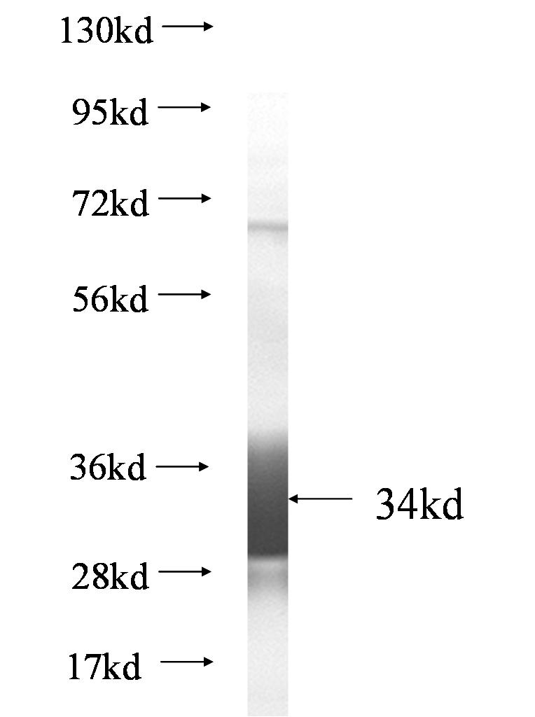 SLC6A4 fusion protein Ag0817 SDS-PAGE SLC6A4 fusion protein Ag0817 SDS-PAGE