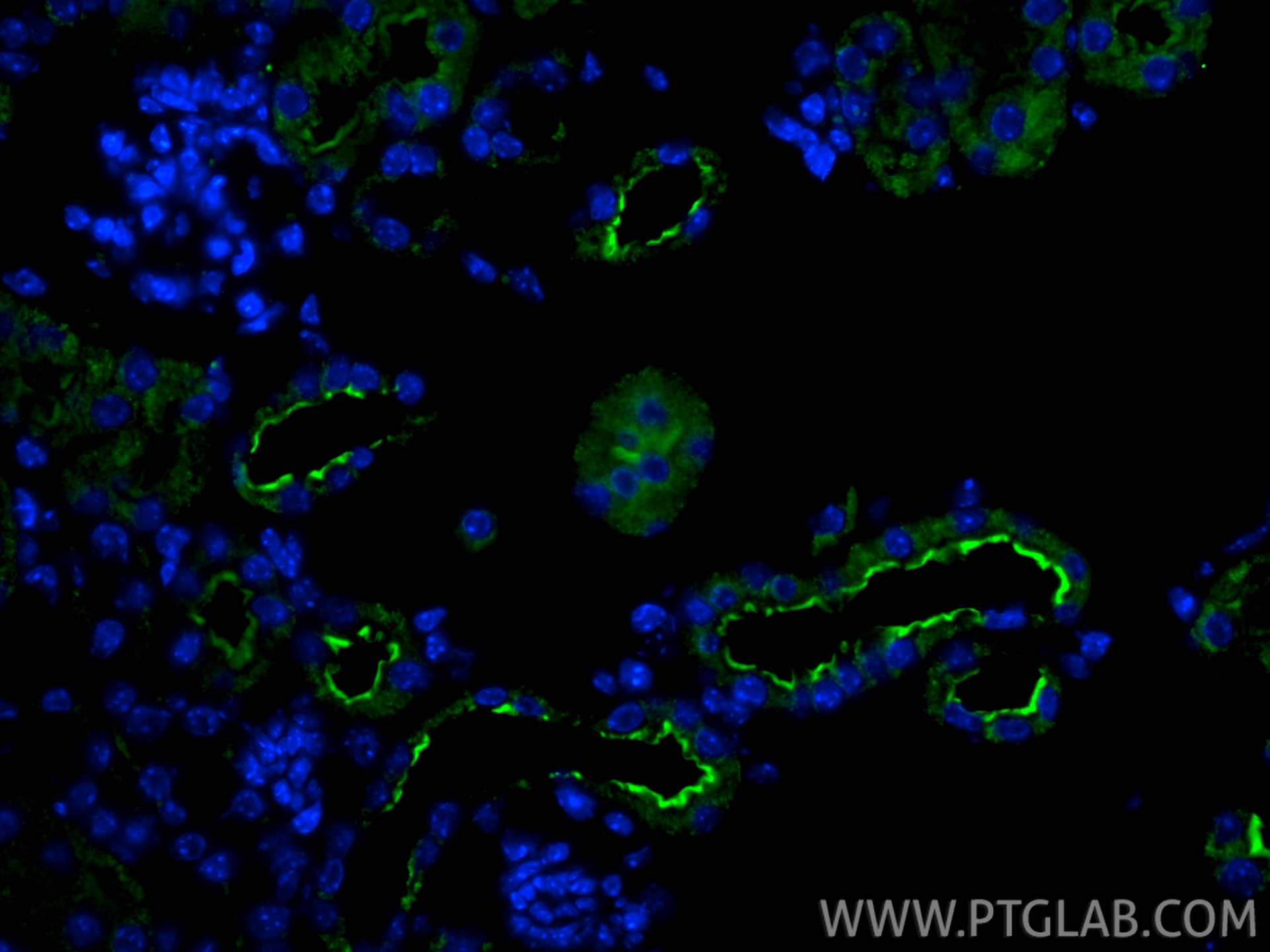 IF Staining of mouse kidney using 26725-1-AP