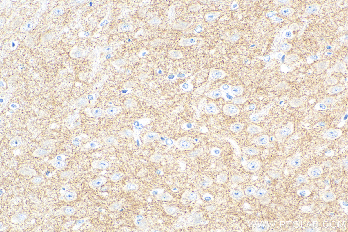 IHC staining of mouse brain using 83412-4-RR