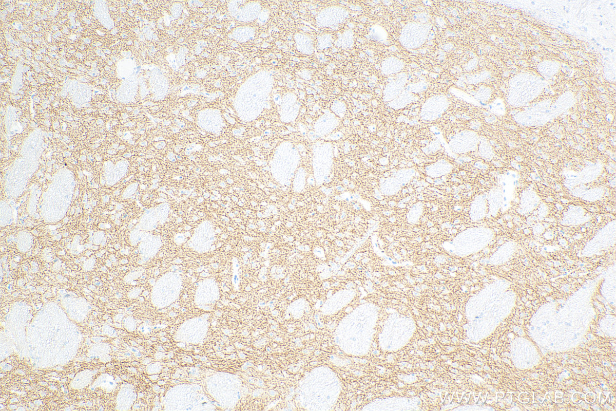 IHC staining of rat brain using 83412-4-RR