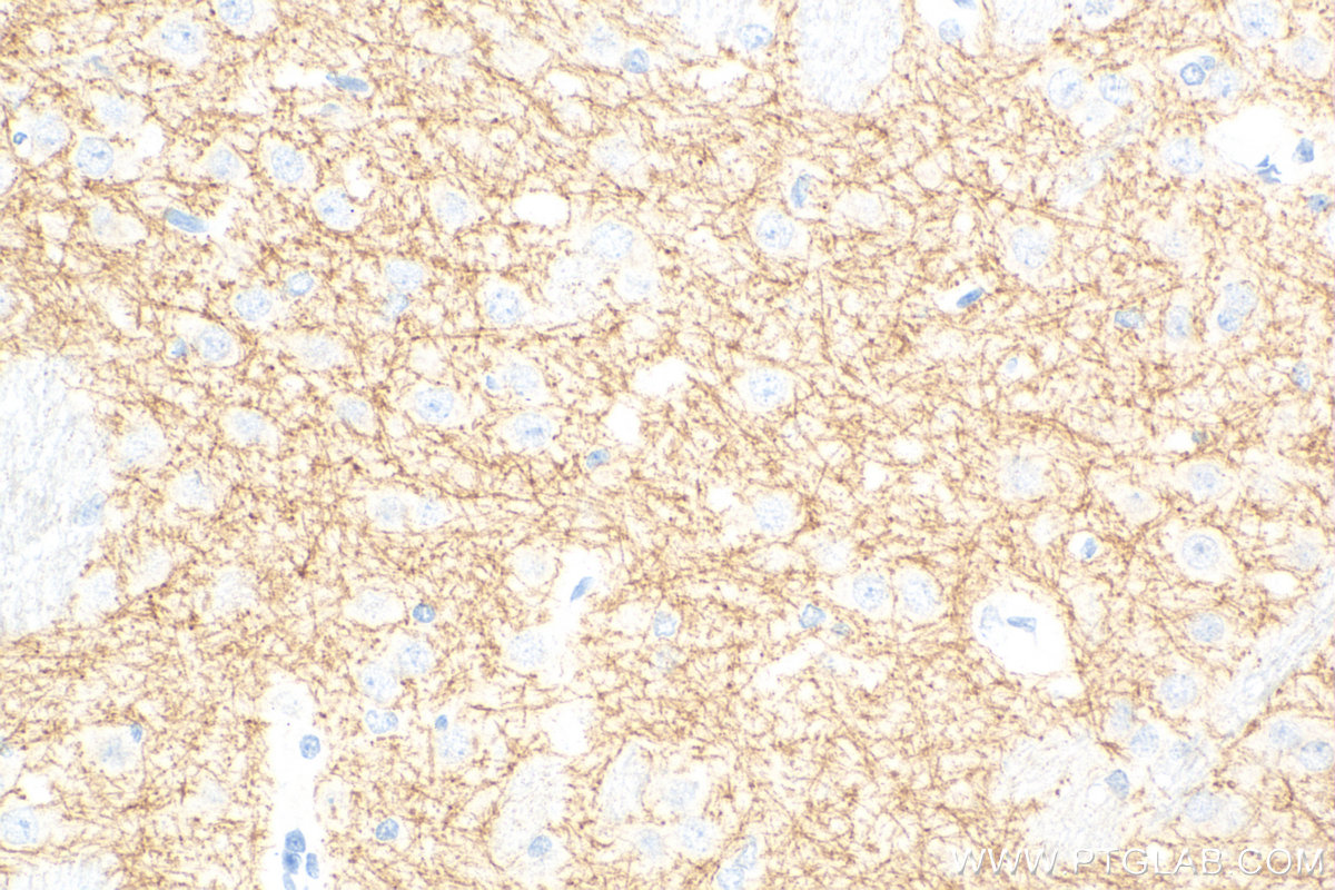 IHC staining of rat brain using 83412-4-RR