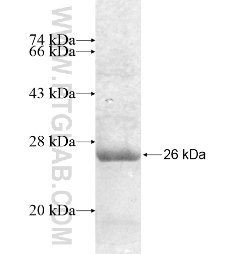 SLC6A7 fusion protein Ag12763 SDS-PAGE SLC6A7 fusion protein Ag12763 SDS-PAGE
