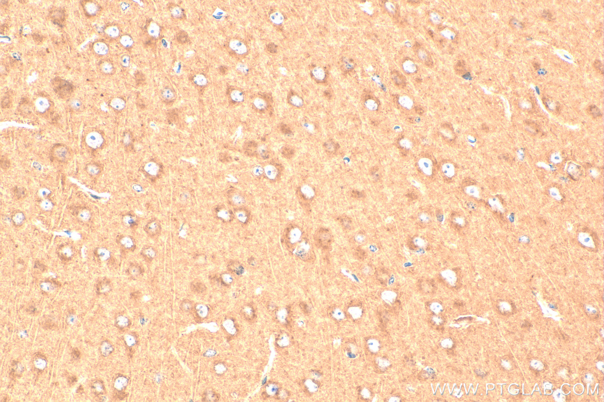 IHC staining of mouse brain using 20299-1-AP