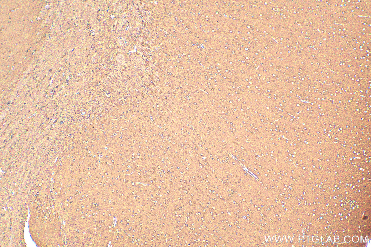 IHC staining of mouse brain using 20299-1-AP