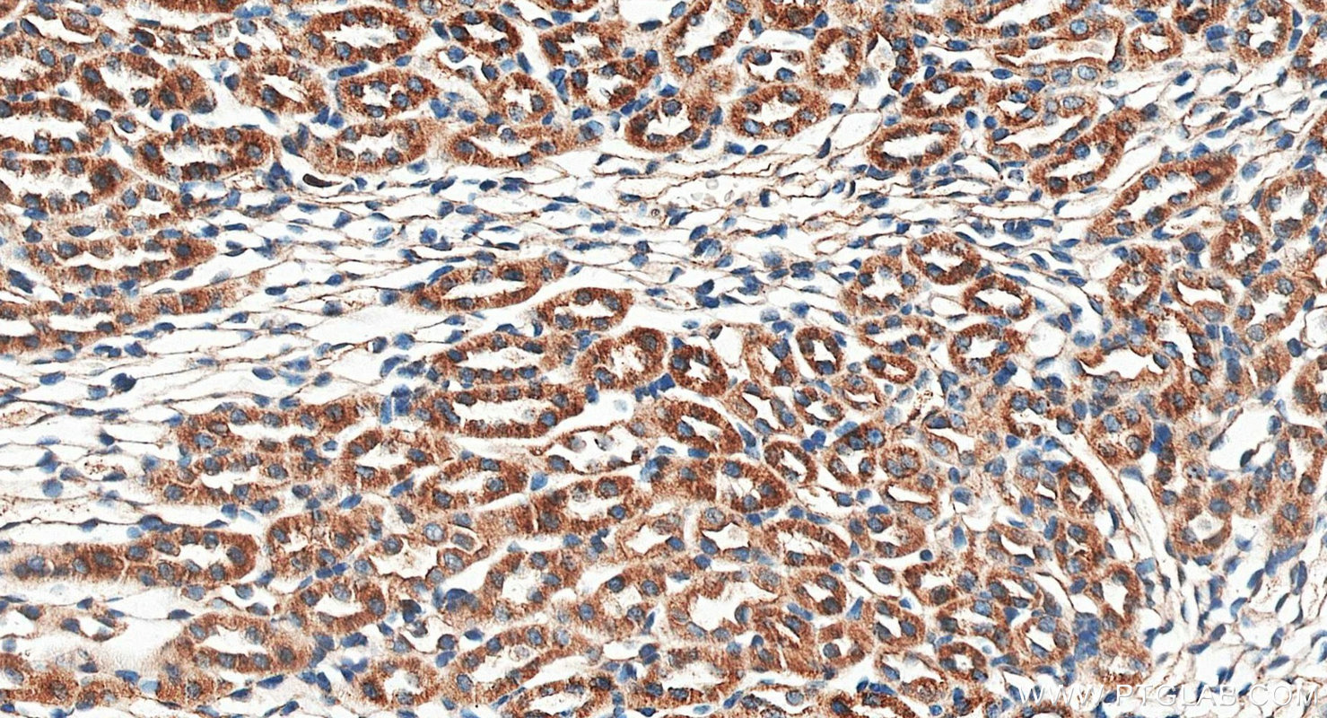 IHC staining of mouse kidney using 20299-1-AP