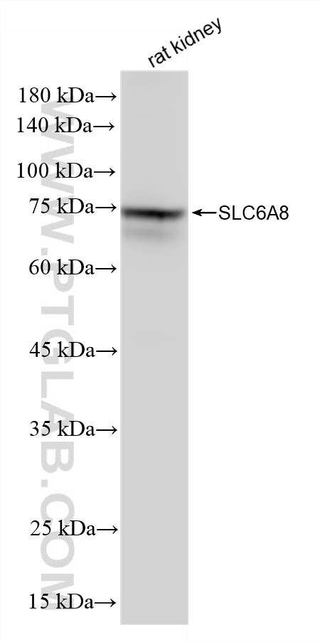 WB analysis of rat kidney using 88049-1-RR WB analysis of rat kidney using 88049-1-RR