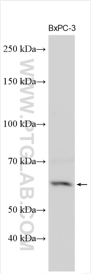 WB analysis using 30971-1-AP