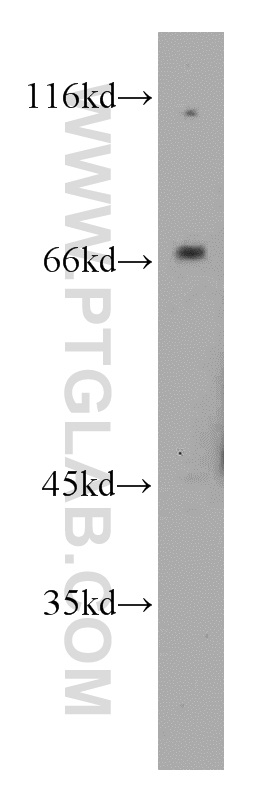 WB analysis of mouse liver using 14195-1-AP