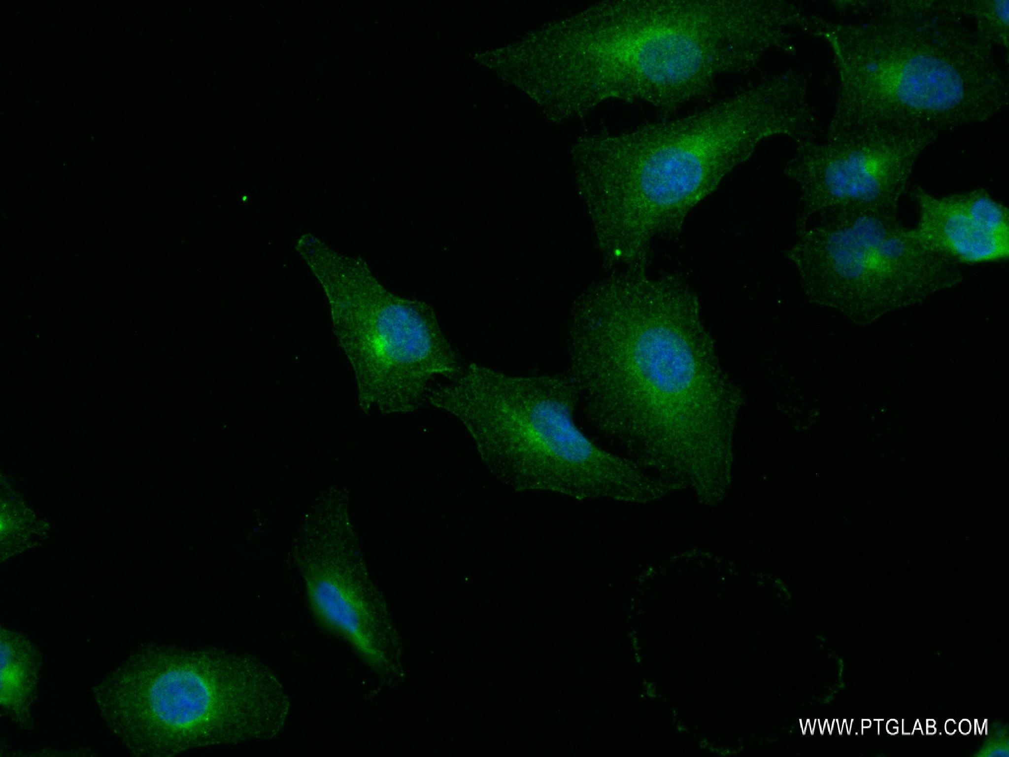 IF Staining of A549 using 82115-2-RR (same clone as 82115-2-PBS)
