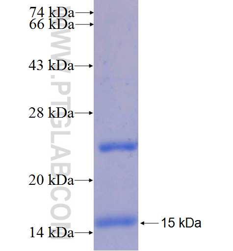 SLC7A11 fusion protein Ag24034 SDS-PAGE SLC7A11 fusion protein Ag24034 SDS-PAGE