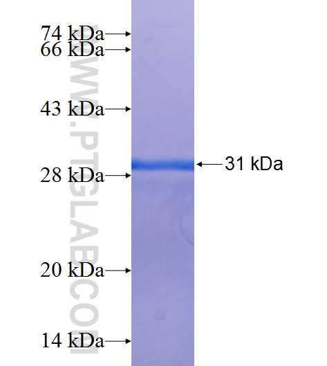 SLC7A11 fusion protein Ag25431 SDS-PAGE