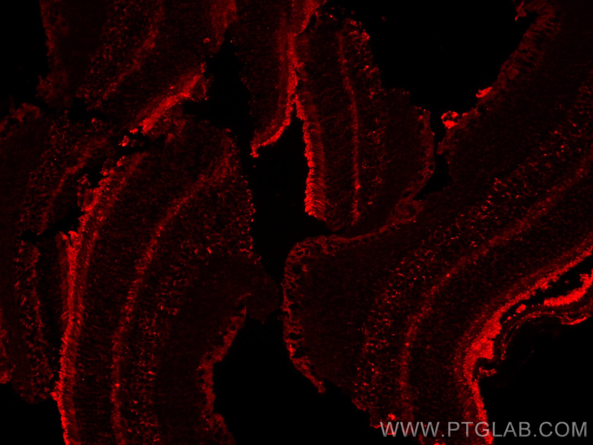 IF Staining of mouse eye using 32384-1-AP
