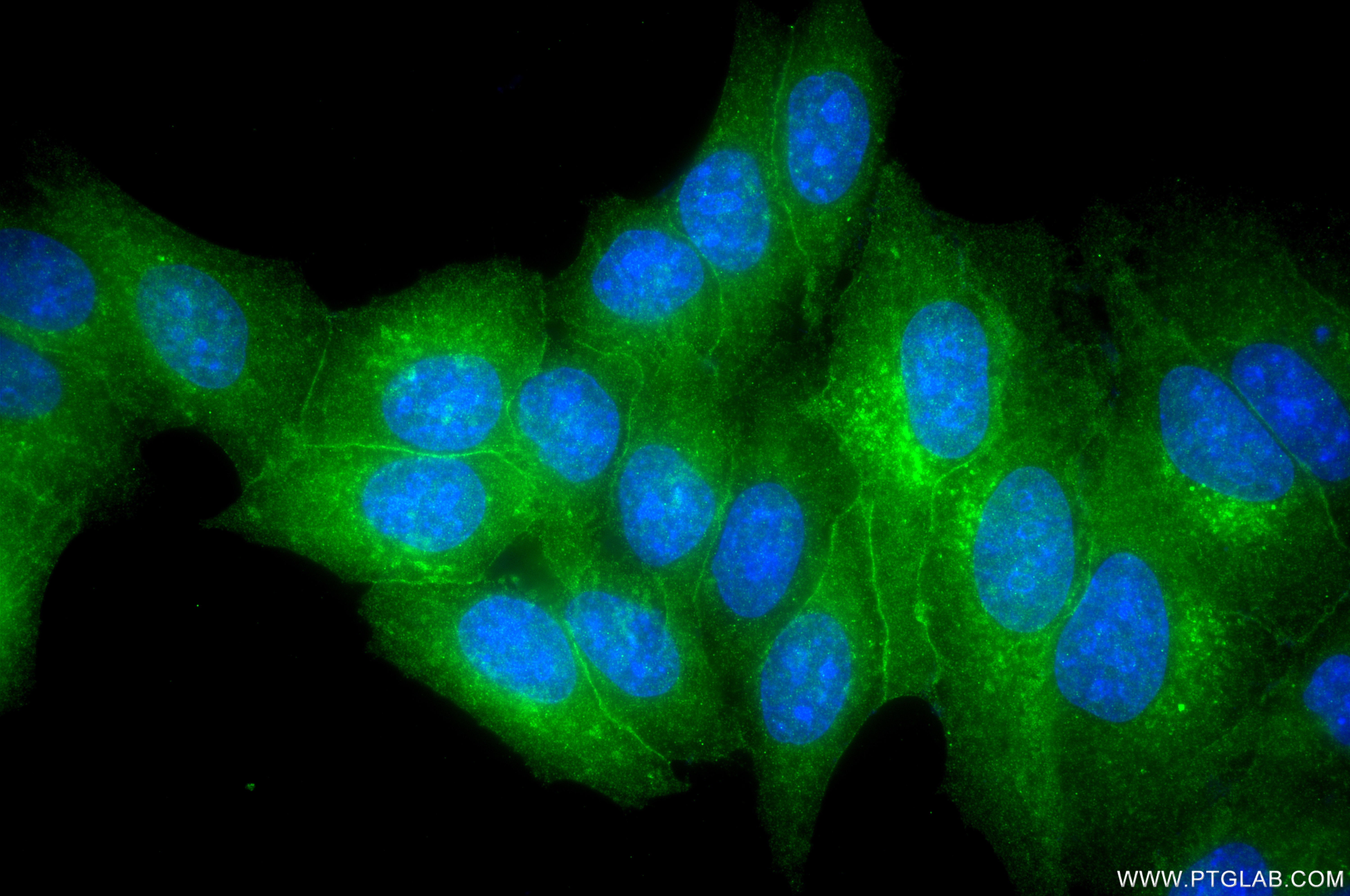 IF Staining of HepG2 using 82115-3-RR